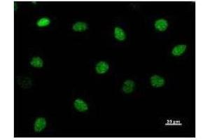 Immunostaining analysis in HeLa cells. (CHD1L 抗体)
