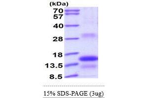 TSHB Protein (AA 21-138) (His tag)