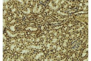 ABIN6277119 at 1/100 staining Mouse kidney tissue by IHC-P. (p63 抗体)