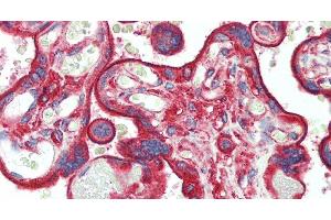 Immunohistochemistry of paraffin-embedded Placenta tissue using CLTC Polyclonal Antibody at dilution of 1:60. (Clathrin Heavy Chain (CLTC) 抗体)