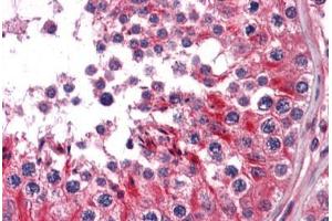 Human Testis: Formalin-Fixed, Paraffin-Embedded (FFPE) (RRAS2 抗体  (AA 1-205))