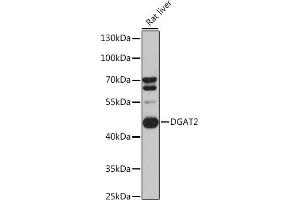 Western blot analysis of extracts of Rat liver cells, using DG antibody (ABIN6130268, ABIN6139559, ABIN6139561 and ABIN6218054) at 1:3000 dilution. (DGAT2 抗体  (AA 113-388))