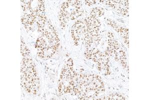 anti-Poly A Specific Ribonuclease (PARN) (AA 589-639) antibody