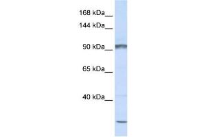 PCDHAC2 antibody used at 1 ug/ml to detect target protein. (PCDHAC2 抗体  (N-Term))