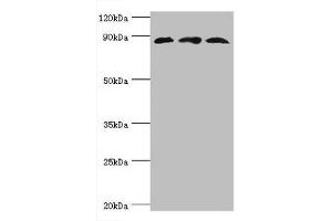 Western blot All lanes: Cullin-1 antibody at 6 μg/mL Lane 1: PC-3 whole cell lysate Lane 2: K562 whole cell lysate Lane 3: Hela whole cell lysate Secondary Goat polyclonal to rabbit IgG at 1/10000 dilution Predicted band size: 90 kDa Observed band size: 90 kDa (Cullin 1 抗体  (AA 500-776))
