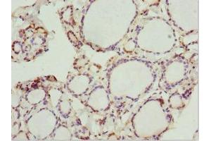 Immunohistochemistry of paraffin-embedded human thyroid tissue using ABIN7162928 at dilution of 1:100 (Peripherin 抗体  (AA 1-260))