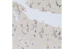 Immunohistochemistry of paraffin-embedded rat brain using NAPA antibody. (NAPA 抗体)