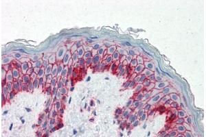 Human Skin (formalin-fixed, paraffin-embedded) stained with B2M antibody ABIN334257 at 5 ug/ml followed by biotinylated anti-mouse IgG secondary antibody ABIN481714, alkaline phosphatase-streptavidin and chromogen. (beta-2 Microglobulin 抗体)