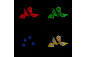 ABIN7095558 and ABIN7099615 staining Hela cells by IF/ICC. (FBXO30 抗体)