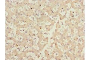 Immunohistochemistry of paraffin-embedded human liver tissue using ABIN7165661 at dilution of 1:100 (IWS1 抗体  (AA 570-819))