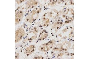 Immunohistochemistry (IHC) image for anti-Karyopherin (Importin) alpha 4 (KPNA4) (AA 1-240) antibody (ABIN3015855)