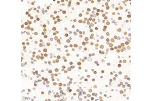 Immunohistochemistry of paraffin embedded mouse neonatal mouse',s brain using LDOCL (ABIN7075411) at dilution of 1:1400 (400x lens) (Retrotransposon Gag-Like Protein 6 (RTL6) 抗体)