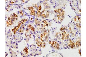 Immunohistochemistry (Paraffin-embedded Sections) (IHC (p)) image for anti-SEL1L adaptor subunit of ERAD E3 ubiquitin ligase (SEL1L) (AA 151-250) antibody (ABIN735953)