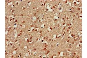 Immunohistochemistry of paraffin-embedded human brain tissue using ABIN7164960 at dilution of 1:100