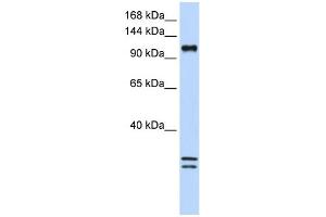 WB Suggested Anti-NCKAP1L Antibody Titration:  0. (NCKAP1L 抗体  (C-Term))