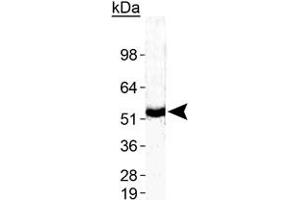 Western blot analysis of ZMPSTE24 in human testis with ZMPSTE24 polyclonal antibody . (ZMPSTE24 抗体  (AA 400-475))