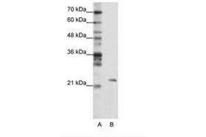 Image no. 1 for anti-Mitochondrial rRNA Methyltransferase 1 Homolog (MRM1) (AA 25-74) antibody (ABIN203015) (MRM1 抗体  (AA 25-74))