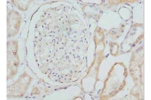 Immunohistochemistry (IHC) image for anti-Cytochrome P450, Family 4, Subfamily V, Polypeptide 2 (CYP4V2) (AA 246-525) antibody (ABIN7149278)