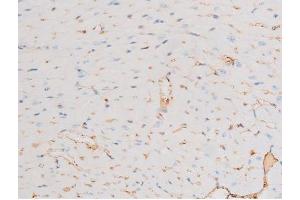 ABIN6267605 at 1/200 staining Mouse heart tissue sections by IHC-P. (Dynamin 1 抗体  (pSer774))