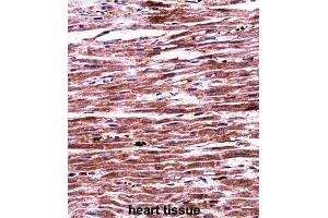 Immunohistochemistry (IHC) image for anti-Ring Finger Protein 19A (RNF19A) antibody (ABIN2997832) (RNF19A 抗体)