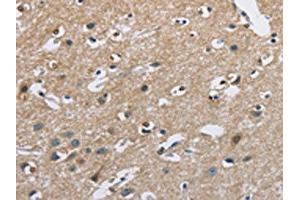 The image on the left is immunohistochemistry of paraffin-embedded Human brain tissue using ABIN7128713(CAB39L Antibody) at dilution 1/40, on the right is treated with fusion protein. (CAB39L 抗体)