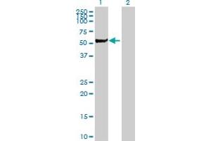 Western Blot analysis of STK3 expression in transfected 293T cell line by STK3 MaxPab polyclonal antibody.