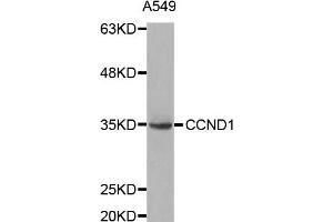 Western blot analysis of extracts of A549 cell lines, using CCND1 antibody. (Cyclin D1 抗体)