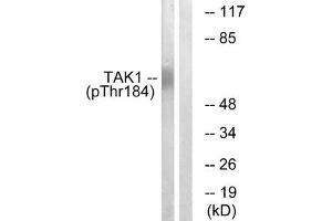 Western blot analysis of extracts from HepG2 cells, treated with TNF (20 ng/mL, 5 mins), using TAK1 (Phospho-Thr184) antibody. (MAP3K7 抗体  (pThr184))