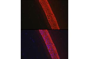 Immunofluorescence analysis of Rat eye using Cytokeratin 12 (KRT12) antibody (ABIN7268087) at dilution of 1:100.