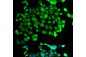 Immunofluorescence analysis of U2OS cells using APOBEC3C Polyclonal Antibody (APOBEC3C 抗体)