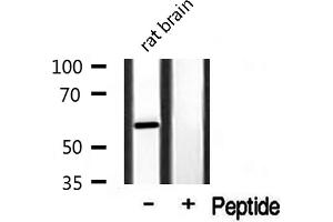 Western blot analysis of extracts from rat Brian, using Cytochrome P450 3A4/5 antibody. (Cytochrome P450 3A4, 3A5 抗体)