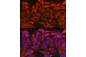 Immunofluorescence analysis of U2OS cells using TXLNA Rabbit pAb (ABIN7270744) at dilution of 1:150 (40x lens). (alpha Taxilin 抗体)