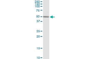 GALNS MaxPab rabbit polyclonal antibody. (GALNS 抗体  (AA 1-522))