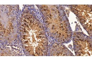 Detection of ON in Mouse Testis Tissue using Polyclonal Antibody to Osteonectin (ON)
