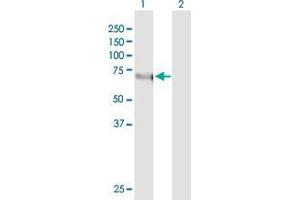 Western Blot analysis of KLF11 expression in transfected 293T cell line by KLF11 monoclonal antibody (M03), clone 10D8. (KLF11 抗体  (AA 404-512))