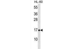Western Blotting (WB) image for anti-phospholipase A2, Group V (PLA2G5) antibody (ABIN2998220) (PLA2G5 抗体)