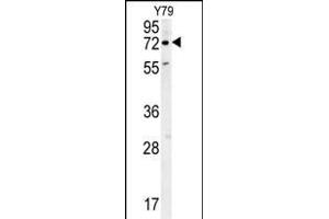 RFT1 Antibody (C-term) (ABIN654046 and ABIN2843951) western blot analysis in Y79 cell line lysates (35 μg/lane). (RFT1 抗体  (C-Term))