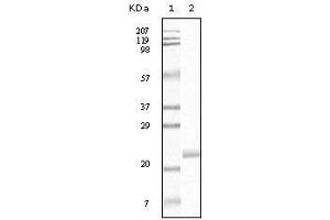 Western blot analysis using EphB4 mouse mAb against truncated EphB4 recombinant protein. (EPH Receptor B4 抗体)