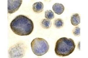 Immunohistochemistry (IHC) image for anti-Chemokine (C-X-C Motif) Receptor 4 (CXCR4) (N-Term) antibody (ABIN1031336) (CXCR4 抗体  (N-Term))