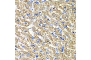 Immunohistochemistry of paraffin-embedded mouse heart using FIBP antibody  at dilution of 1:100 (40x lens). (FIBP 抗体  (AA 1-364))