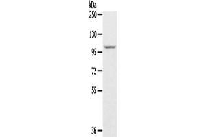 Gel: 6 % SDS-PAGE, Lysate: 40 μg, Lane: A549 cells, Primary antibody: ABIN7131212(STARD8 Antibody) at dilution 1/250, Secondary antibody: Goat anti rabbit IgG at 1/8000 dilution, Exposure time: 10 seconds (STARD8 抗体)