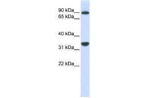 Western Blotting (WB) image for anti-Ribosomal RNA Processing 1 Homolog B (RRP1B) antibody (ABIN2458964) (RRP1B 抗体)