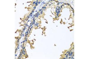 Immunohistochemistry of paraffin-embedded human prostate using NLGN4Y antibody (ABIN6133011, ABIN6144652, ABIN6144653 and ABIN6220667) at dilution of 1:100 (40x lens). (Neuroligin Y 抗体  (AA 122-256))