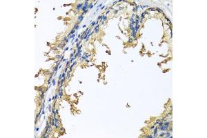 Immunohistochemistry of paraffin-embedded human prostate using NLGN4Y antibody (ABIN6133011, ABIN6144652, ABIN6144653 and ABIN6220667) at dilution of 1:100 (40x lens). (Neuroligin Y 抗体  (AA 122-256))