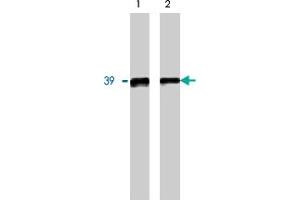 Western blot analysis using GNB5 polyclonal antibody on 20 ng (1) and 10 ng (2) purified GNB5 protein. (GNB5 抗体)