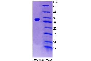 SDS-PAGE analysis of Human SGCd Protein. (SGCD 蛋白)