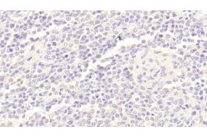 Detection of BLK in Human Spleen Tissue using Polyclonal Antibody to B-Lymphoid Tyrosine Kinase (BLK)