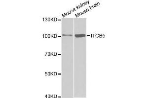 Western blot analysis of extracts of various cell lines, using ITGB5 antibody. (Integrin beta 5 抗体  (AA 490-720))