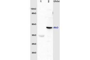 L1 rat brain lysates L2 mouse plasma lysates probed with Anti Fibrinogen gamma chain Polyclonal Antibody, Unconjugated (ABIN872908) at 1:200 in 4 °C. (FGG 抗体  (AA 151-250))