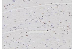 ABIN6276467 at 1/100 staining Rat heart tissue by IHC-P. (IRF4 抗体  (C-Term))